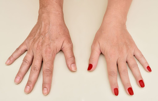 7 Signs of Aging Hands and How to Treat Them