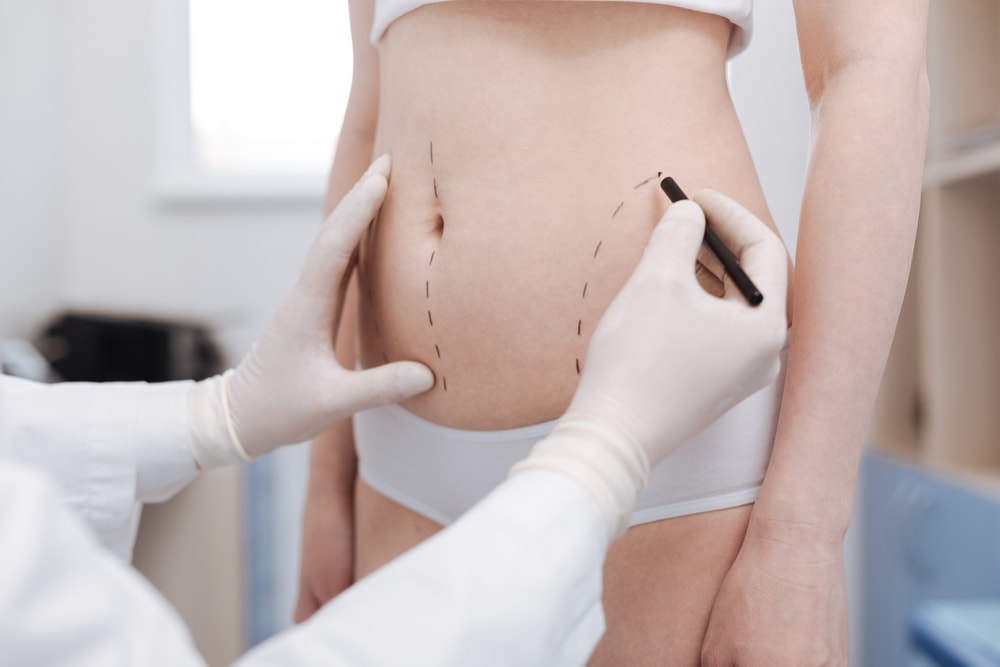 Nervous About Liposuction? Don’t Be – Let’s Clear Up The Myths!