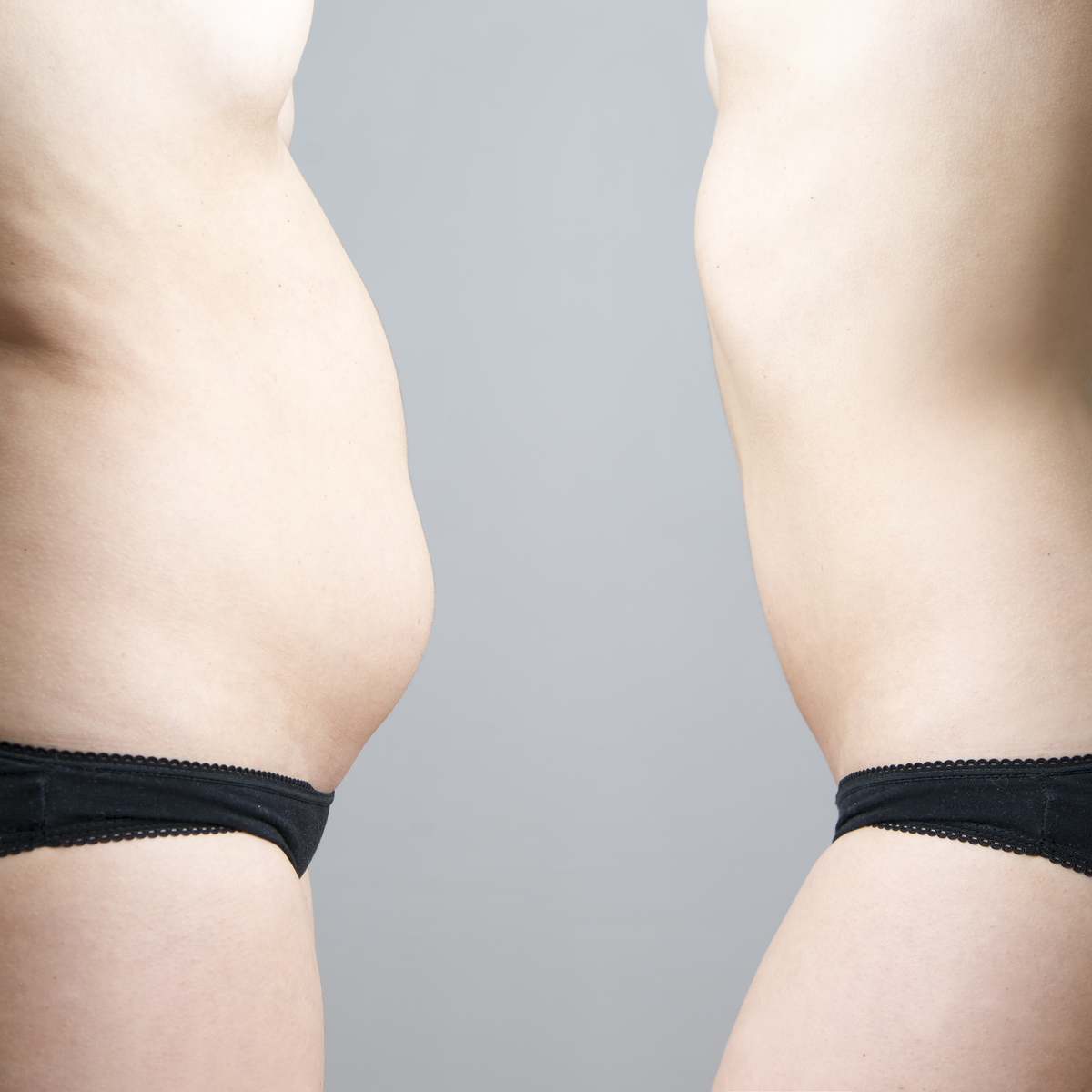 Plastic Surgery Planning