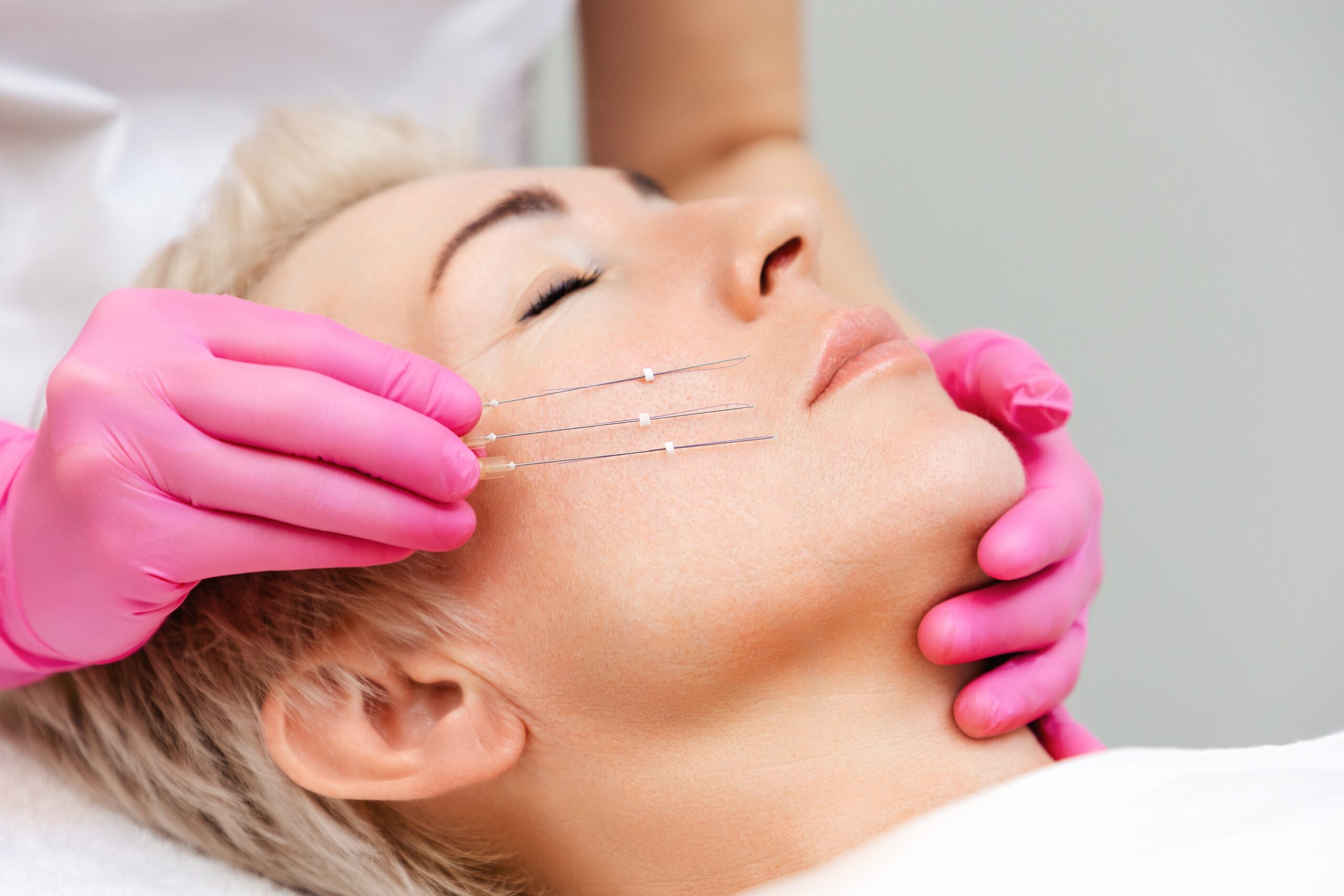 Experience the Benefits of a Thread Lift with Beverly Fischer, MD