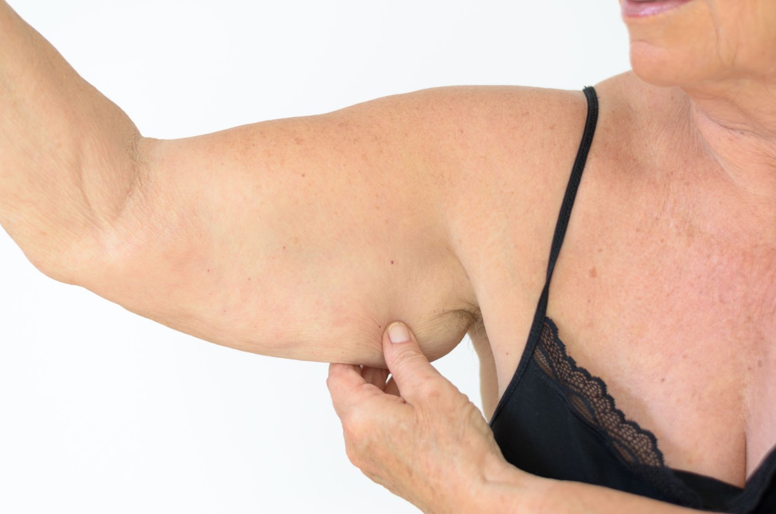How to Fix Flabby Arms