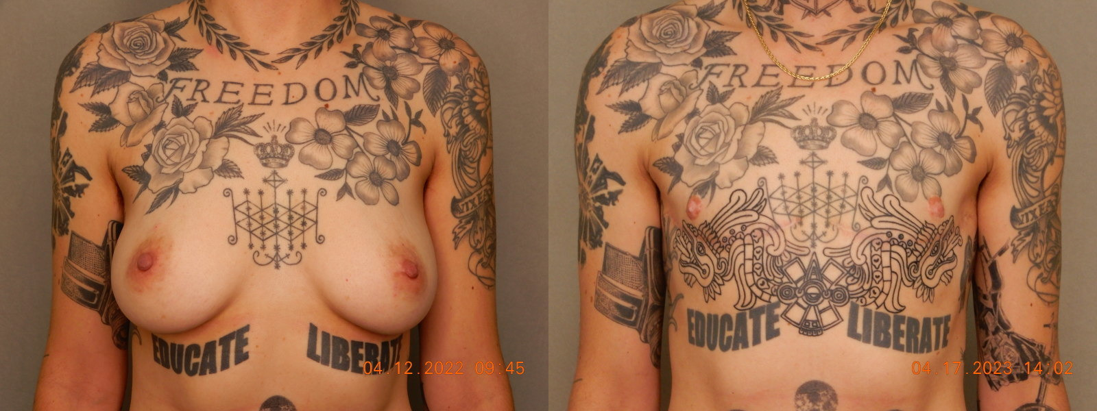 before and after female to male