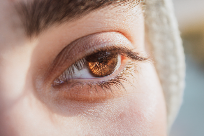 $300 Off Eye Lift (Blepharoplasty)